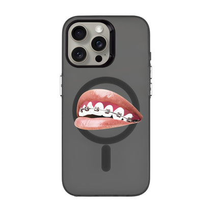 ORTHODONTIST-iPhone 15 Pro Max Hold Kılıf MagSafe Özellikli