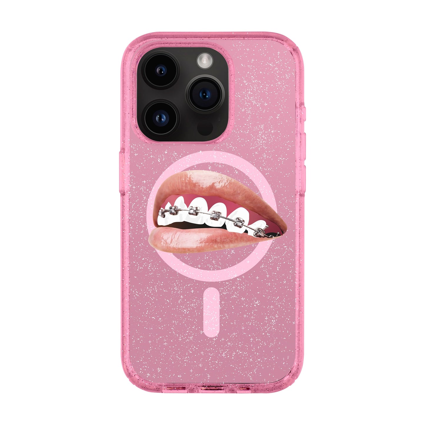 ORTHODONTIST-iPhone 14 Pro Shiny Kılıf MagSafe Özellikli