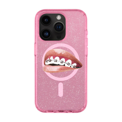 ORTHODONTIST-iPhone 14 Pro Shiny Kılıf MagSafe Özellikli