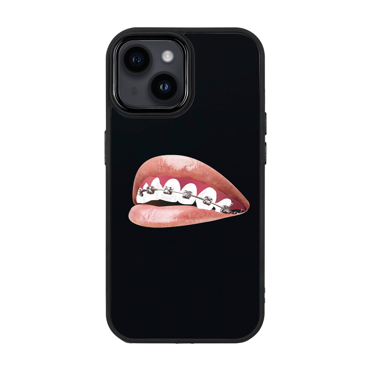 ORTHODONTIST-Proof Kılıf - iPhone 14