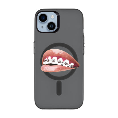 ORTHODONTIST-iPhone 14 Plus Hold Kılıf MagSafe Özellikli