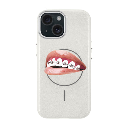 ORTHODONTIST-iPhone 15 Plus Radiant Kılıf MagSafe Özellikli