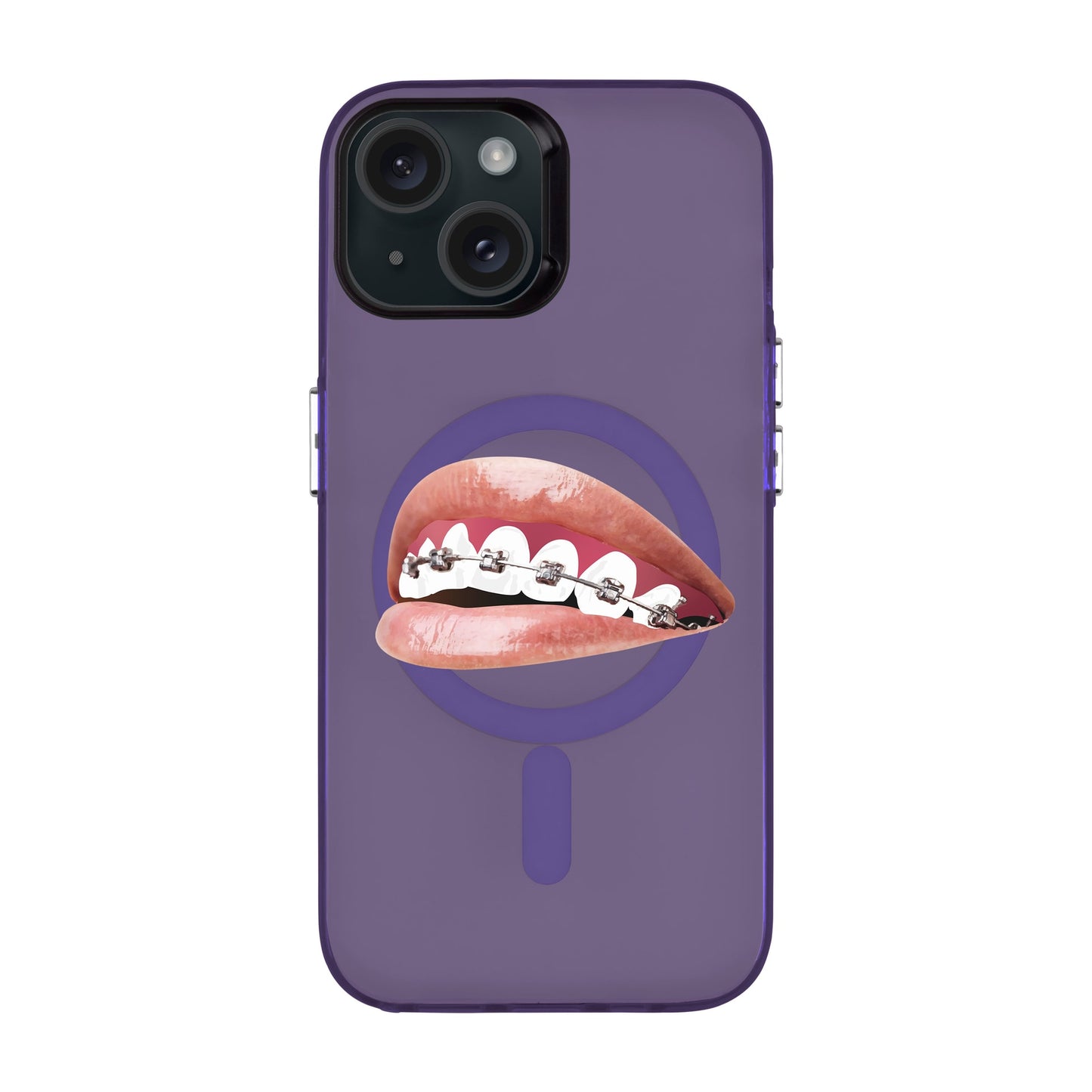 ORTHODONTIST-iPhone 15 Hold Kılıf MagSafe Özellikli