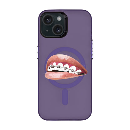 ORTHODONTIST-iPhone 15 Hold Kılıf MagSafe Özellikli