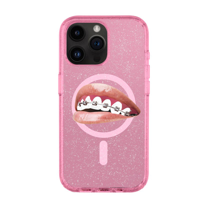 ORTHODONTIST-iPhone 14 Pro Max Shiny Kılıf MagSafe Özellikli