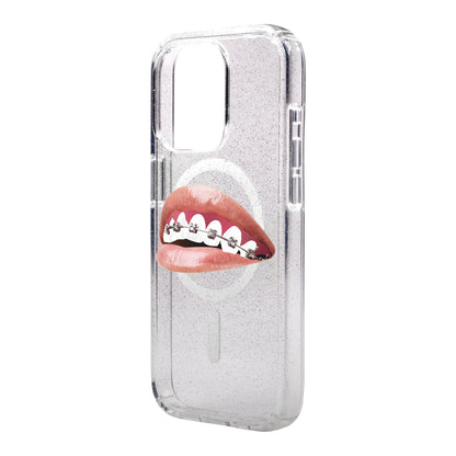 ORTHODONTIST-iPhone 15 Pro Max Shiny Kılıf MagSafe Özellikli