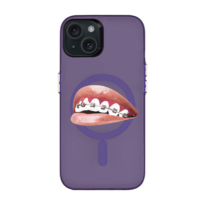 ORTHODONTIST-iPhone 15 Plus Hold Kılıf MagSafe Özellikli