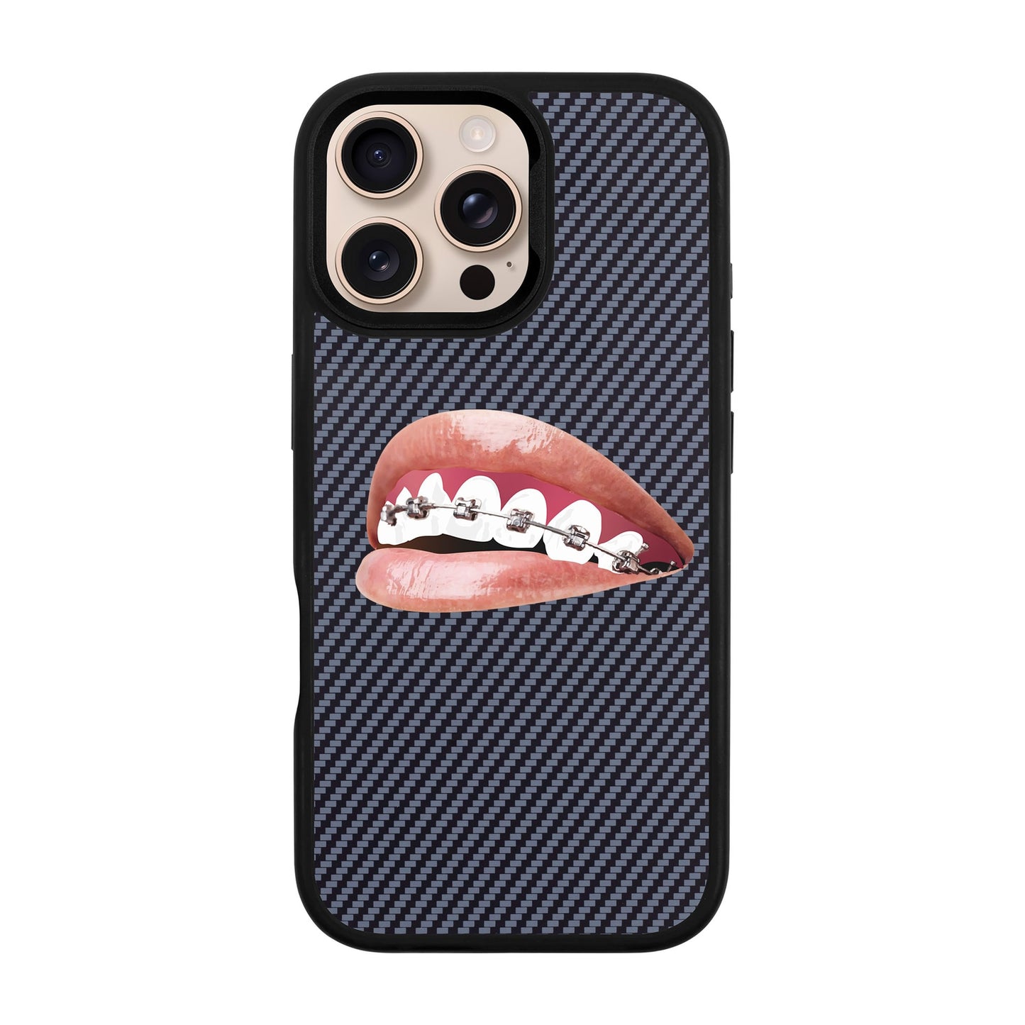 ORTHODONTIST-iPhone 16 Pro Max Plaid Kılıf MagSafe Özellikli