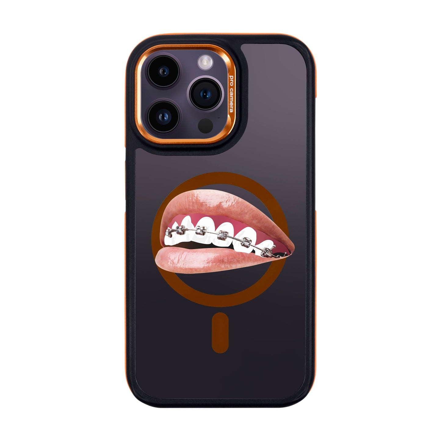 ORTHODONTIST-iPhone 14 Pro Max Dark Kılıf MagSafe Özellikli