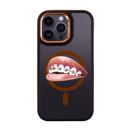 ORTHODONTIST-iPhone 14 Pro Max Dark Kılıf MagSafe Özellikli