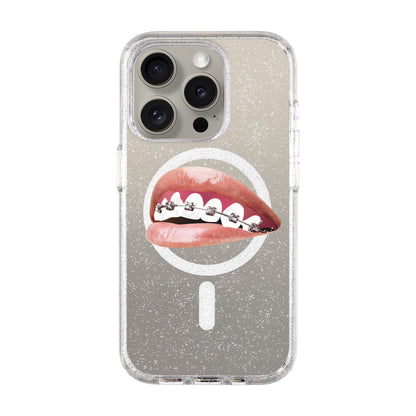 ORTHODONTIST-iPhone 15 Pro Shiny Kılıf MagSafe Özellikli