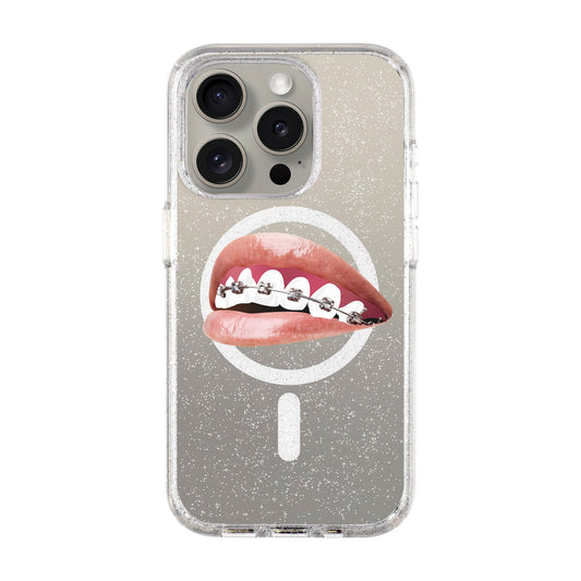 ORTHODONTIST-iPhone 15 Pro Shiny Kılıf MagSafe Özellikli