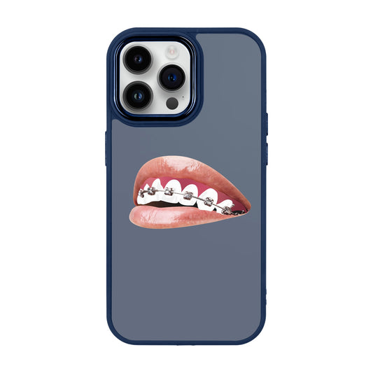 ORTHODONTIST-iPhone 14 Pro Max Proof Kılıf