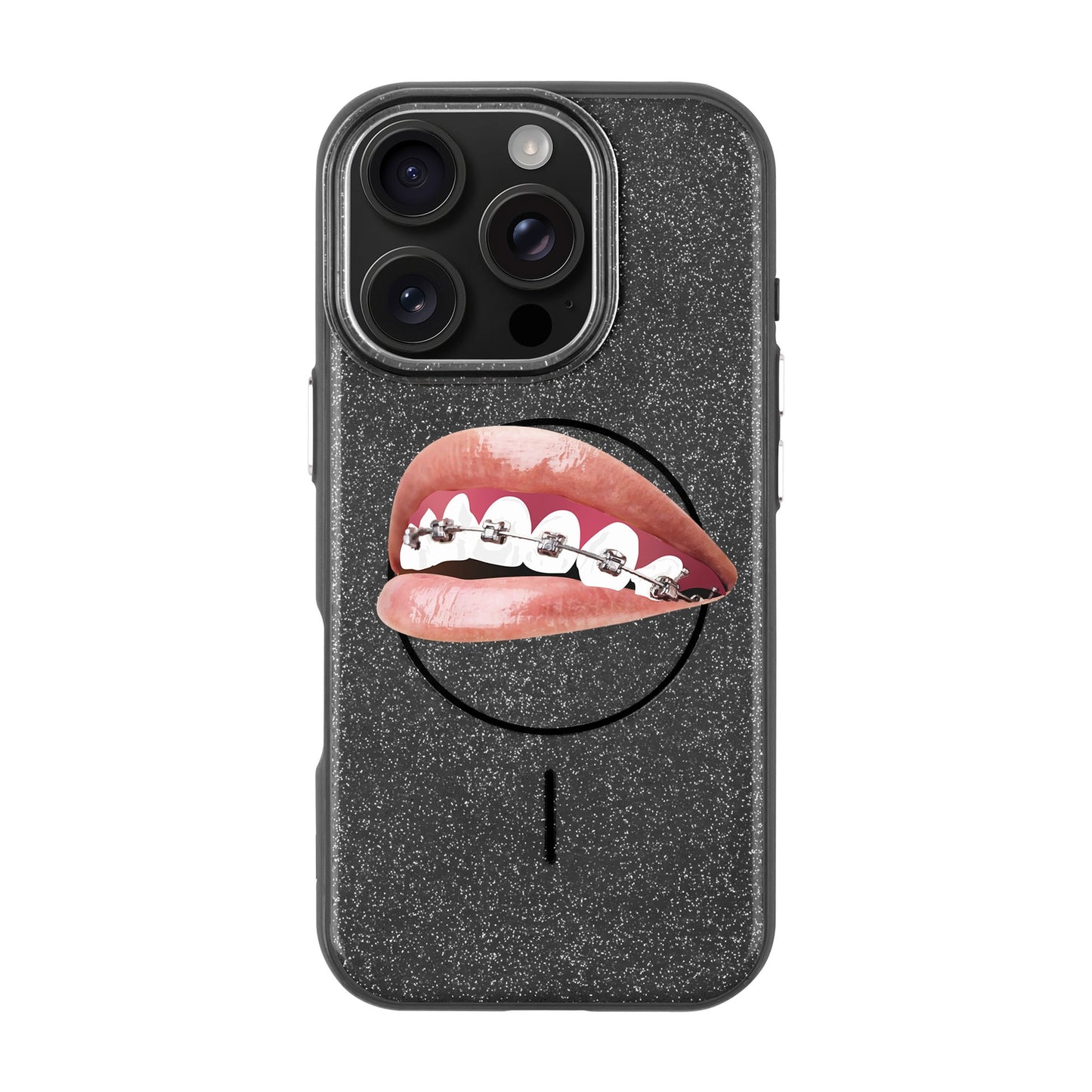 ORTHODONTIST-iPhone 16 Pro Radiant Kılıf MagSafe Özellikli
