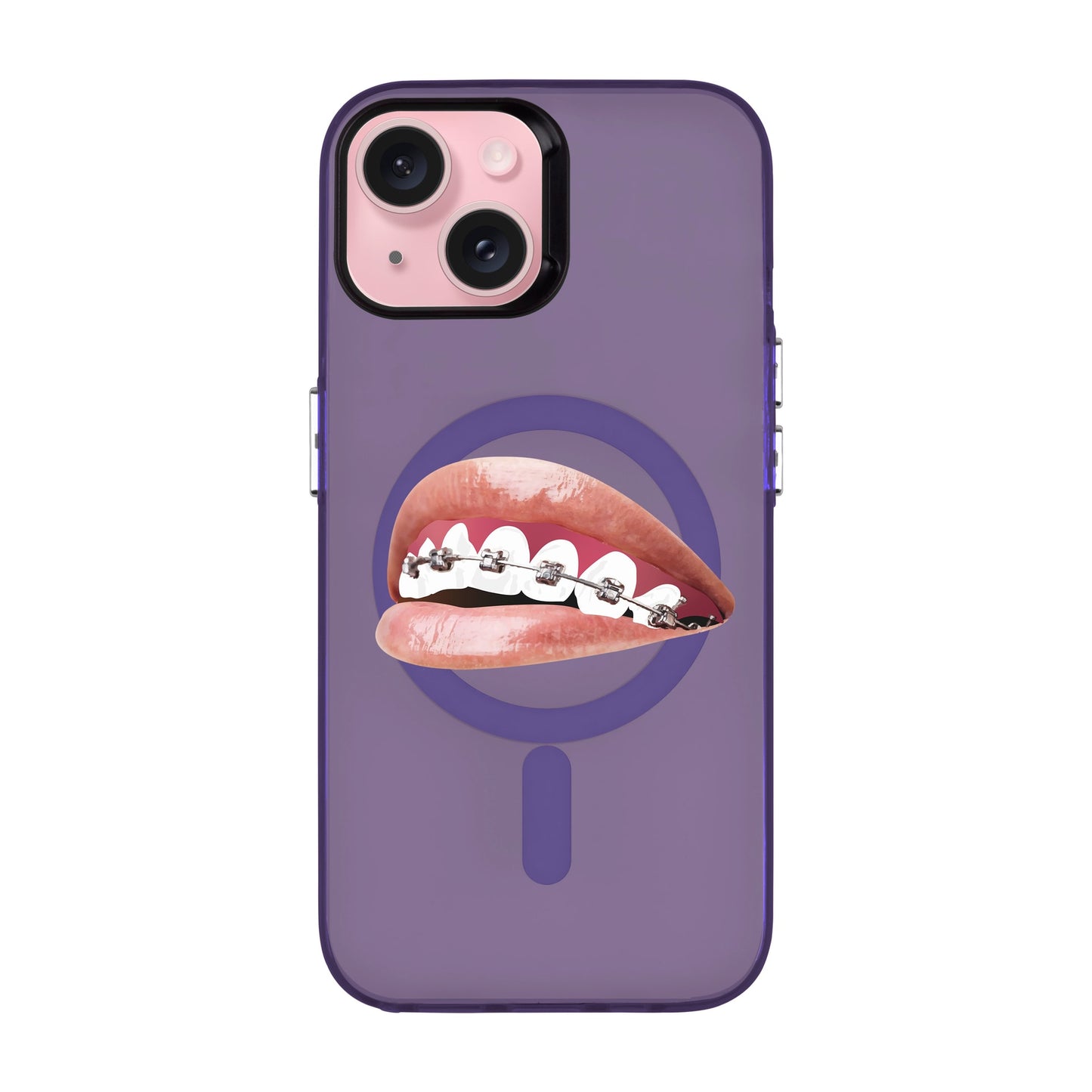ORTHODONTIST-iPhone 15 Hold Kılıf MagSafe Özellikli