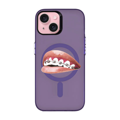 ORTHODONTIST-iPhone 15 Hold Kılıf MagSafe Özellikli