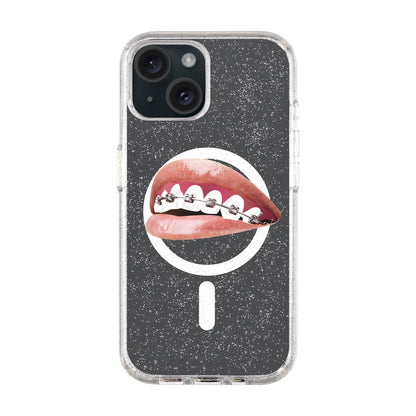 ORTHODONTIST-iPhone 15 Plus Shiny Kılıf MagSafe Özellikli