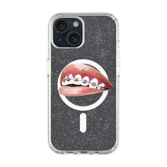 ORTHODONTIST-iPhone 15 Plus Shiny Kılıf MagSafe Özellikli