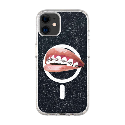ORTHODONTIST-iPhone 11 Shiny Kılıf MagSafe Özellikli