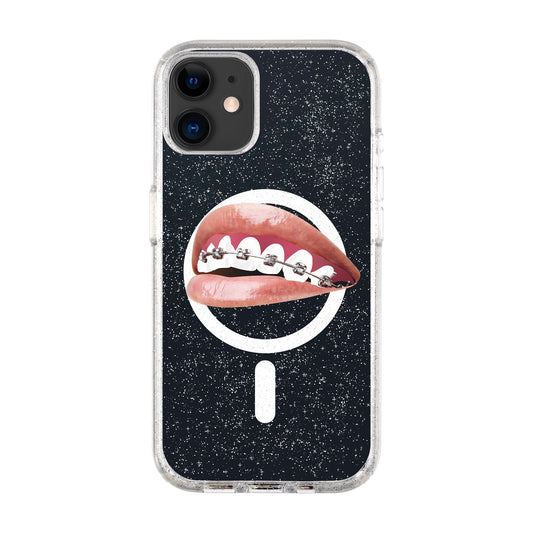 ORTHODONTIST-iPhone 11 Shiny Kılıf MagSafe Özellikli