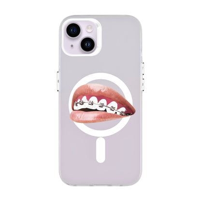ORTHODONTIST-iPhone 14 Plus Hold Kılıf MagSafe Özellikli