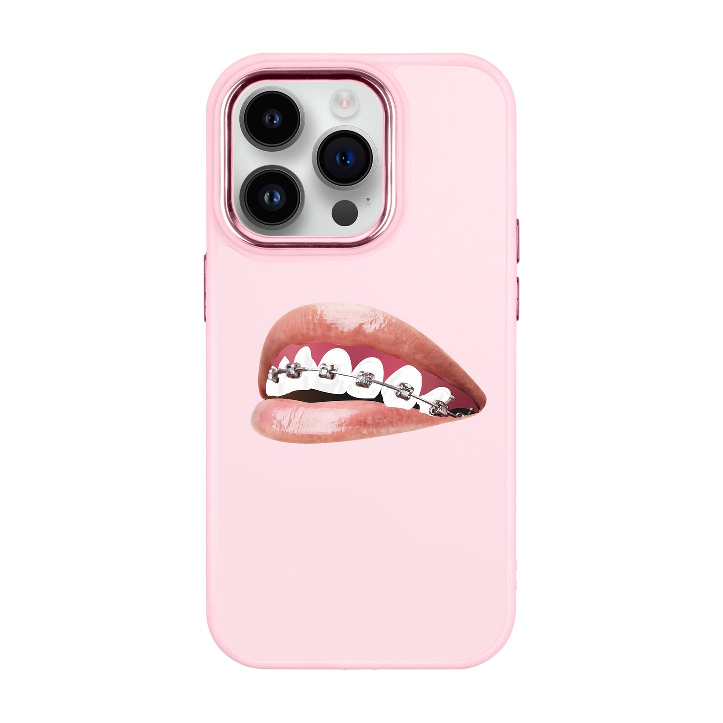 ORTHODONTIST-iPhone 14 Pro Proof Kılıf
