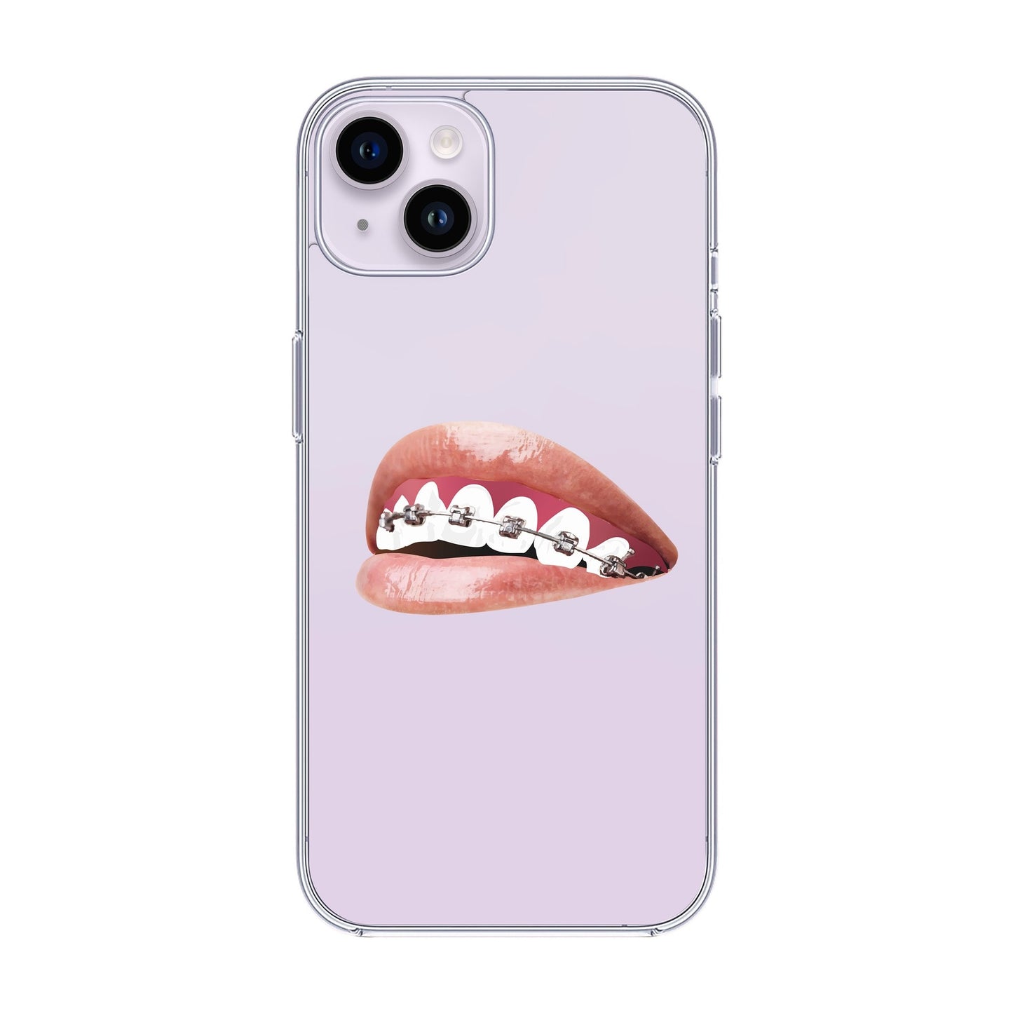 ORTHODONTIST-iPhone 14 Plus Solid Kılıf
