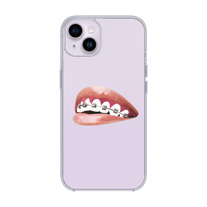 ORTHODONTIST-iPhone 14 Plus Solid Kılıf