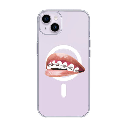 ORTHODONTIST-iPhone 7 / 8 / SE Solid Kılıf MagSafe Özellikli