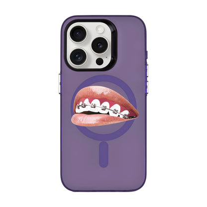 ORTHODONTIST-iPhone 15 Pro Hold Kılıf MagSafe Özellikli