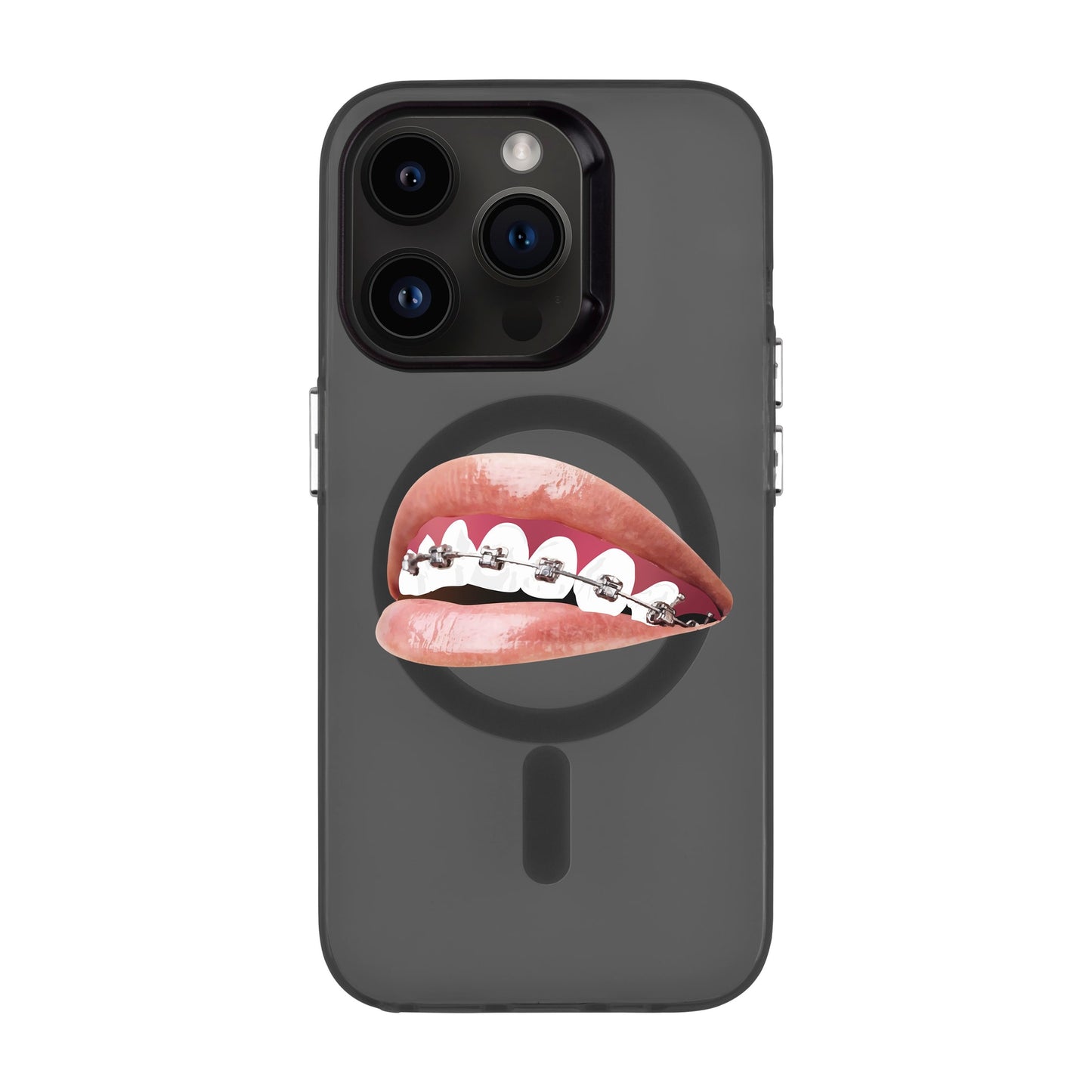ORTHODONTIST-iPhone 14 Pro Hold Kılıf MagSafe Özellikli