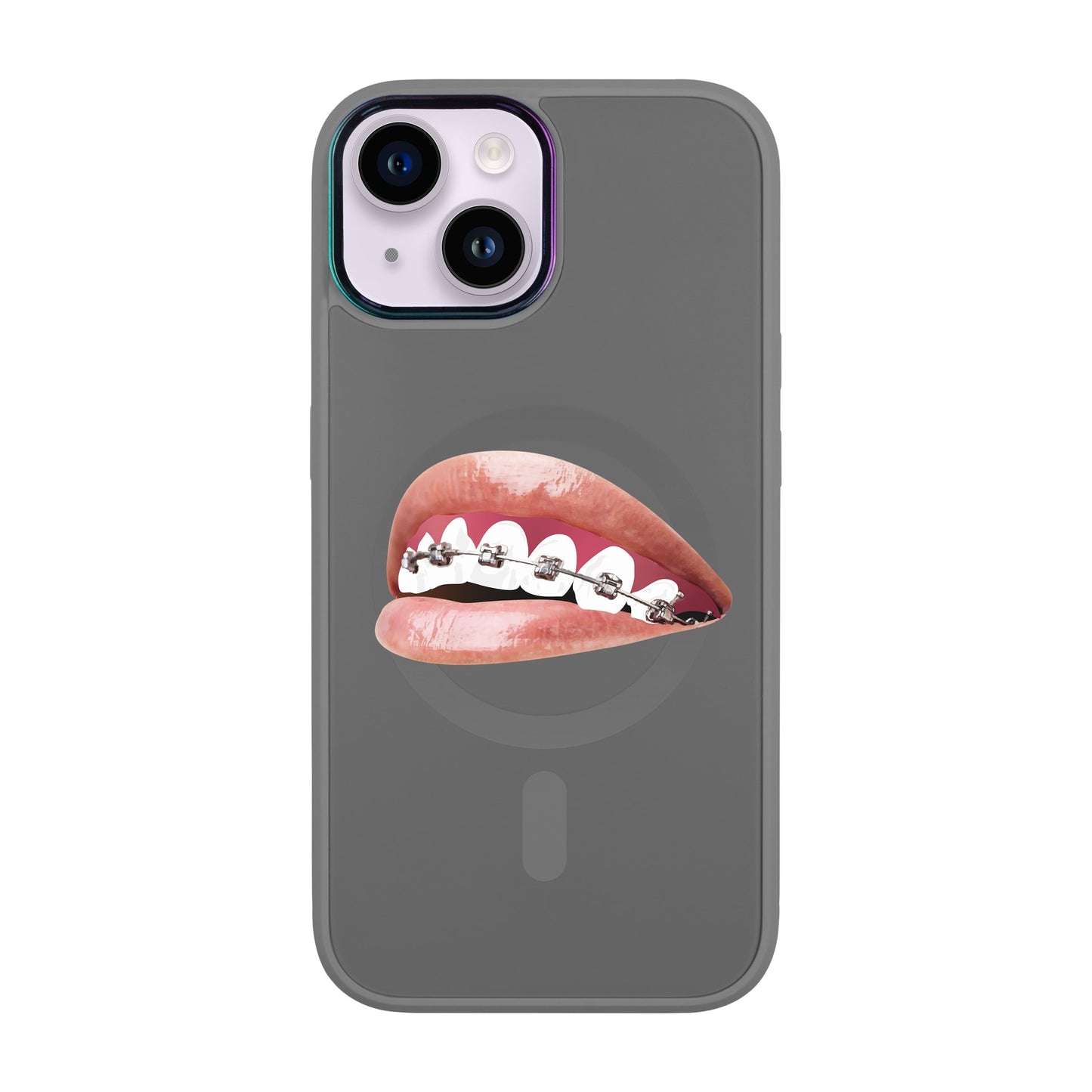 ORTHODONTİST-iPhone 12 Vigor Kılıf MagSafe Özellikli