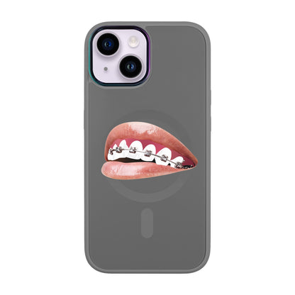ORTHODONTİST-iPhone 12 Vigor Kılıf MagSafe Özellikli