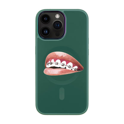 ORTHODONTİST-iPhone 14 Pro Max Vigor Kılıf MagSafe Özellikli