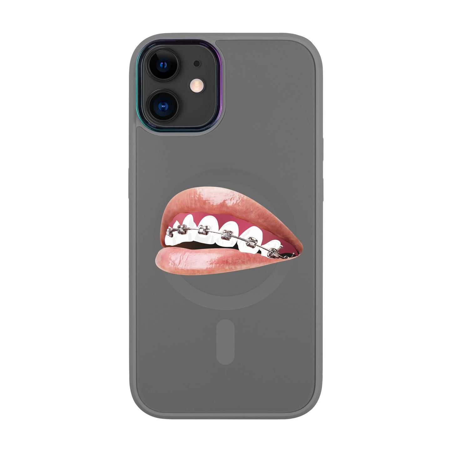 ORTHODONTİST-Vigor Kılıf MagSafe Özellikli - iPhone 11