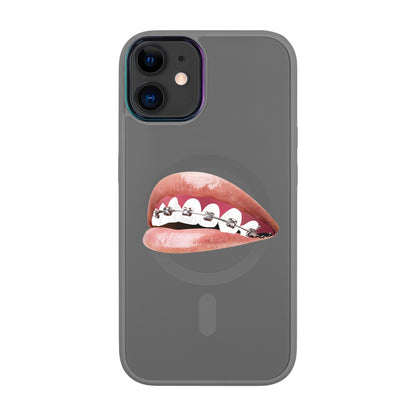 ORTHODONTİST-Vigor Kılıf MagSafe Özellikli - iPhone 11