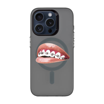 ORTHODONTIST-iPhone 15 Pro Hold Kılıf MagSafe Özellikli
