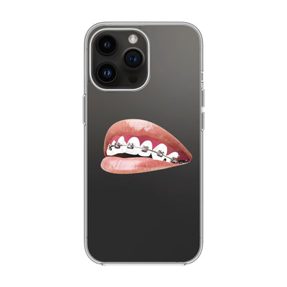 ORTHODONTIST-iPhone 14 Pro Max Solid Kılıf