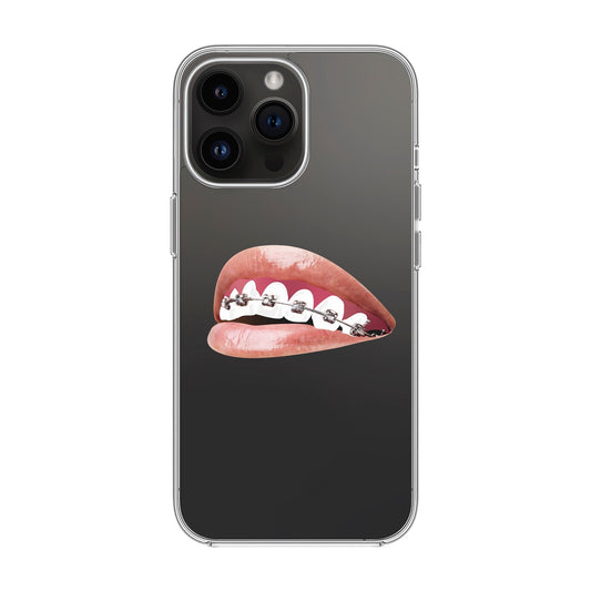 ORTHODONTIST-iPhone 14 Pro Max Solid Kılıf