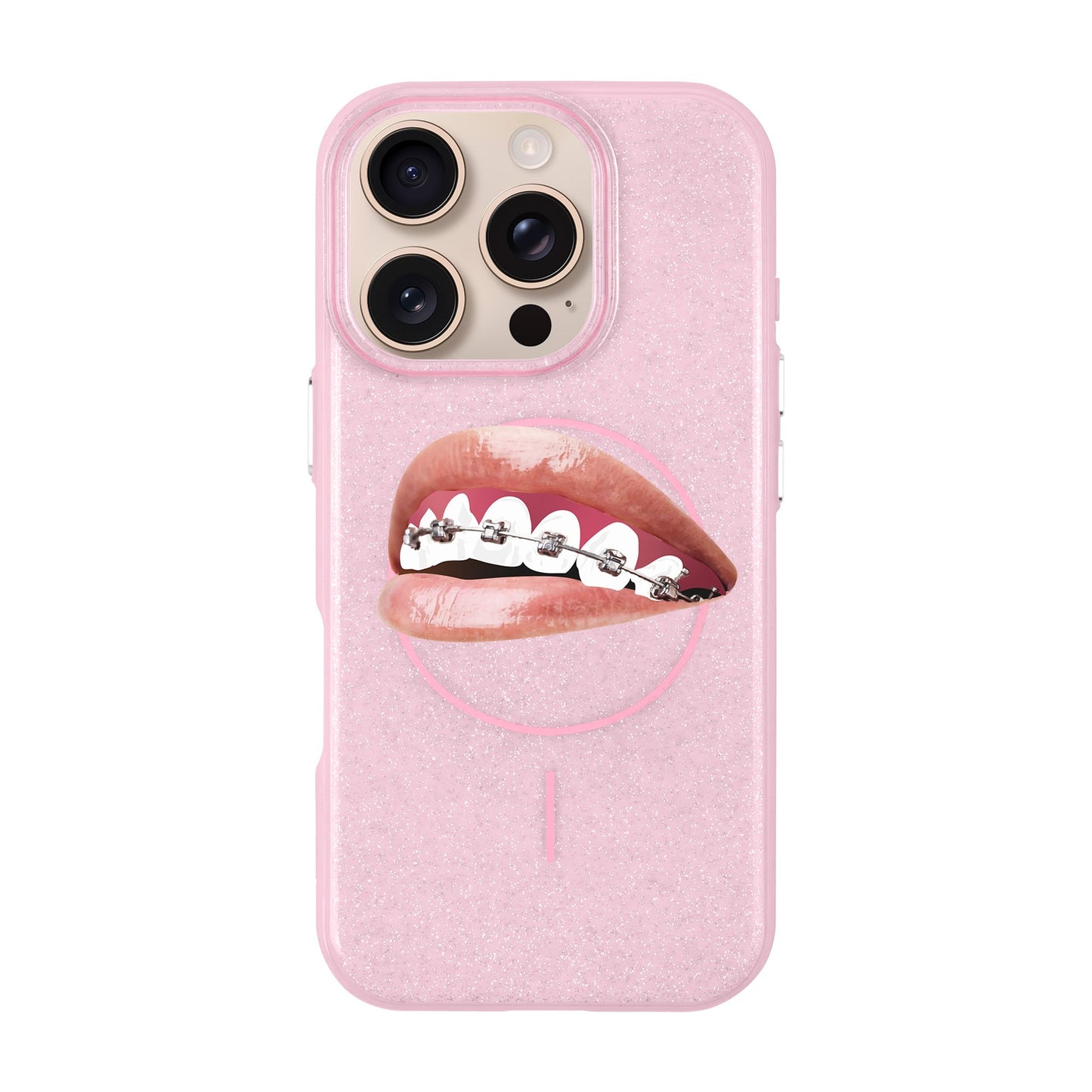 ORTHODONTIST-iPhone 16 Pro Radiant Kılıf MagSafe Özellikli