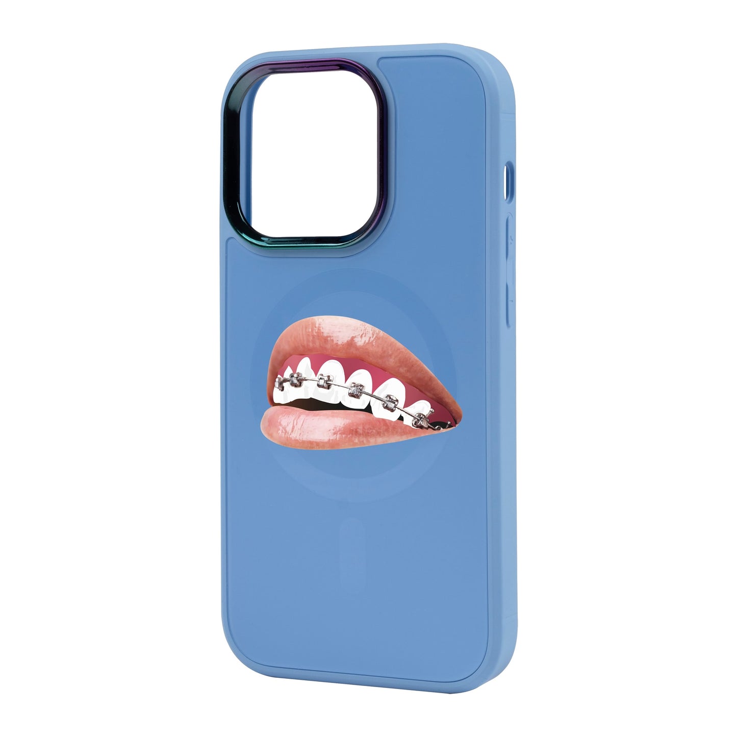 ORTHODONTİST-Vigor Kılıf MagSafe Özellikli - iPhone 14 Pro