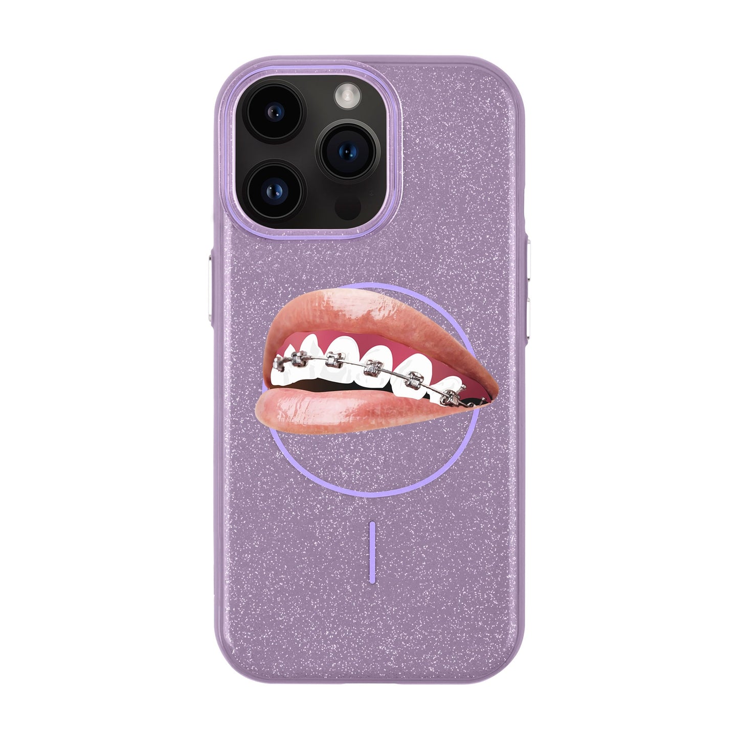 ORTHODONTIST-iPhone 14 Pro Max Radiant Kılıf MagSafe Özellikli