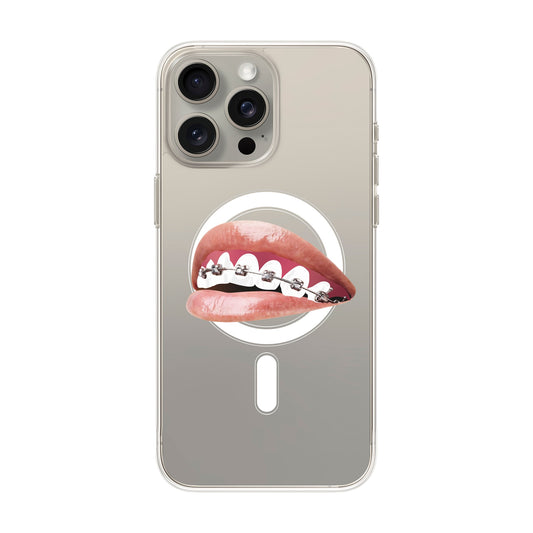 ORTHODONTIST-iPhone 15 Pro Max Solid Kılıf MagSafe Özellikli