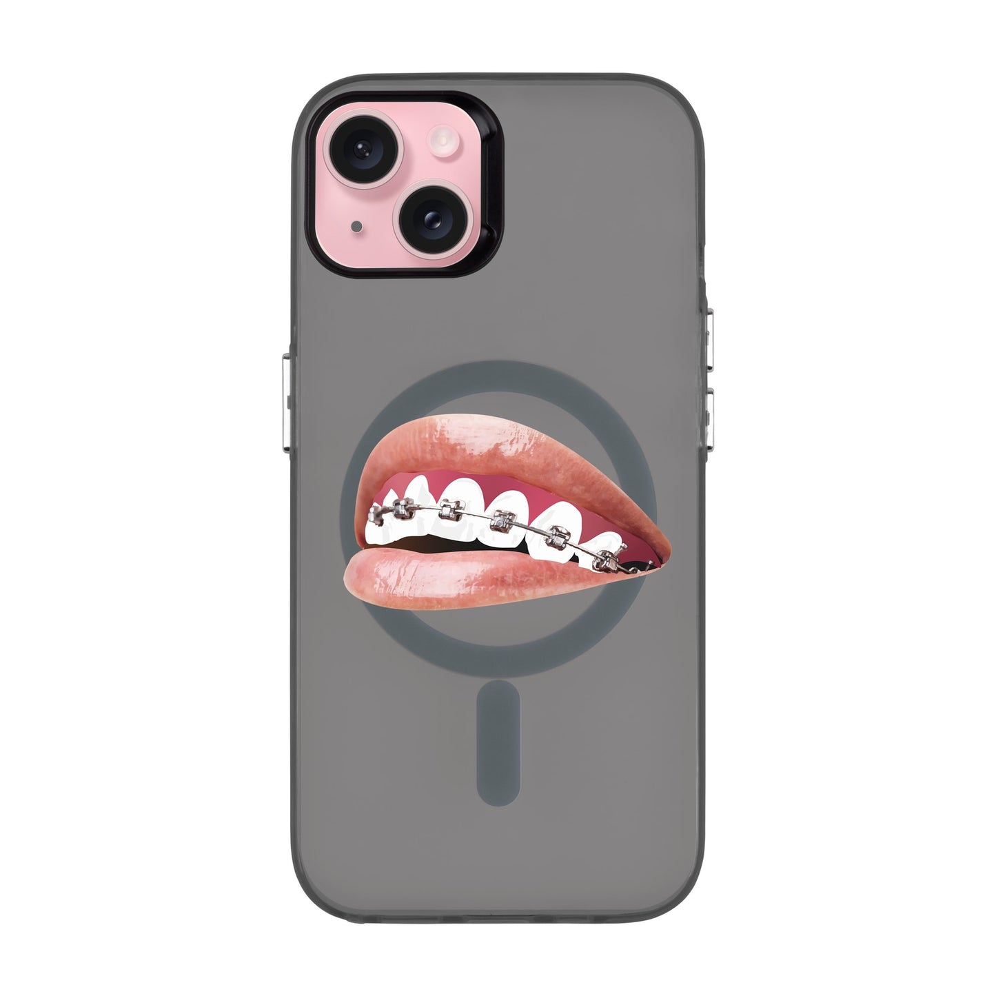 ORTHODONTIST-iPhone 15 Plus Hold Kılıf MagSafe Özellikli
