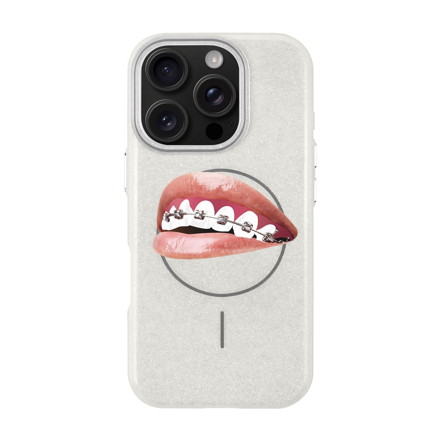 ORTHODONTIST-iPhone 16 Pro Radiant Kılıf MagSafe Özellikli