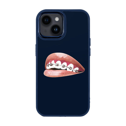 ORTHODONTIST-Proof Kılıf - iPhone 14