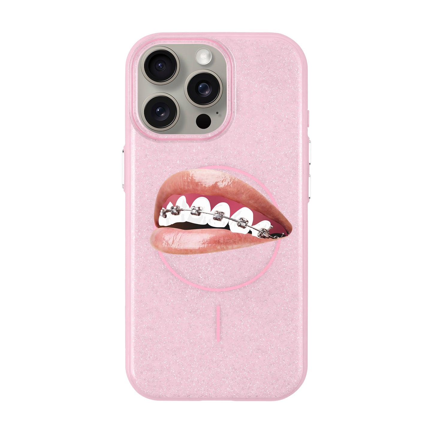 ORTHODONTIST-iPhone 15 Pro Max Radiant Kılıf MagSafe Özellikli