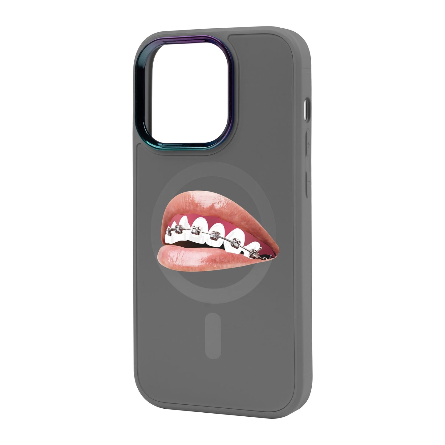 ORTHODONTİST-Vigor Kılıf MagSafe Özellikli - iPhone 14 Pro