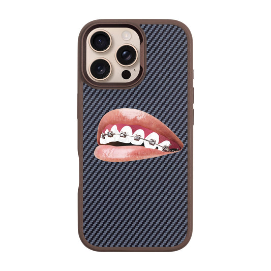 ORTHODONTIST-iPhone 16 Pro Max Plaid Kılıf MagSafe Özellikli