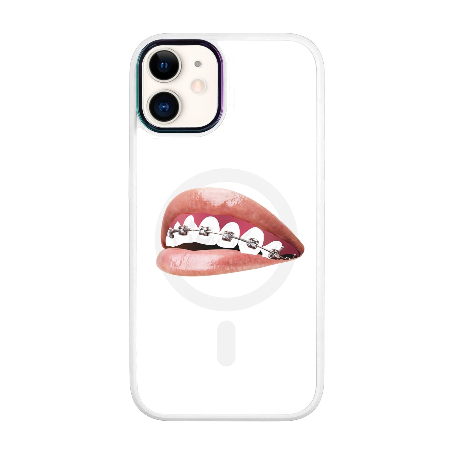 ORTHODONTİST-Vigor Kılıf MagSafe Özellikli - iPhone 11